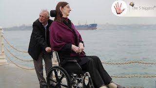 Teenage Giant and Smallest Dwarfs: Humans Who Come in All Shapes and Forms! ~ Body Bizarre!