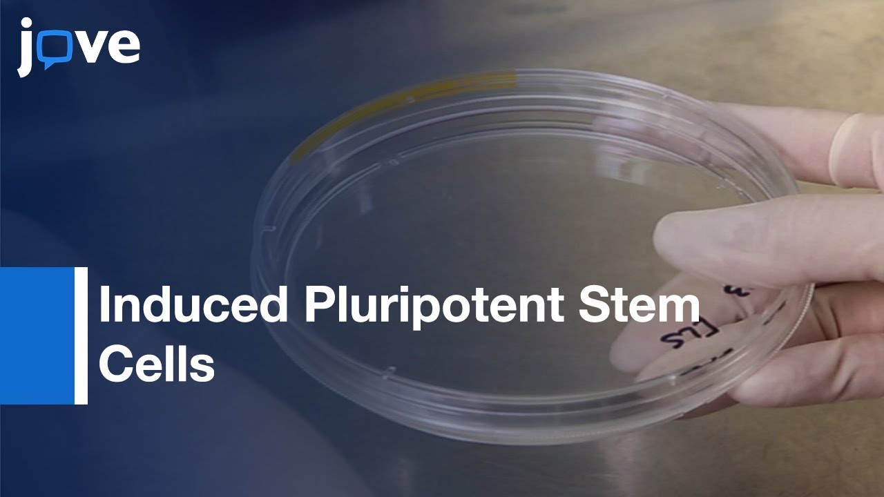 Induced Pluripotent Stem Cells Generation Using Fibroblast Protocol