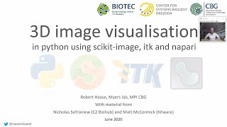 12d 3D Image Visualisation and Processing in Python using scikit-image, itk and napari