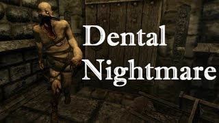 阿津實況 失憶症 牙醫惡夢 Amnesia Dental Nightmare