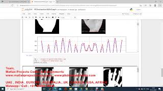 Palmprint recognition python code || Palm print ROI feature extraction and matching python code