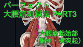 パーフェクト大腰筋刺鍼法　ＰＡＲＴ３　大腰筋起始部（椎体、横突起）