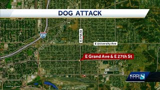 Woman walking to Iowa State Fair attacked by dogs, police say
