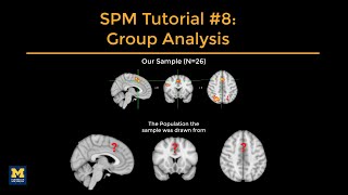 SPM Tutorial #8: Group-Level Analysis