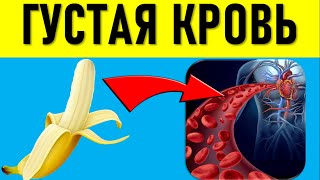 Шокирующая правда: Как бананы загущают кровь и образуют тромбы? Густая кровь: польза и вред бананов