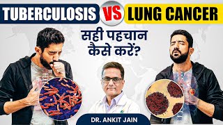 World Lung Cancer Day: Tuberculosis Vs Lung Cancer | टीबी और लंग कैंसर: सही पहचान कैसे करें?