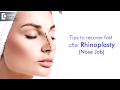 How to make bruises go away faster after rhinoplasty? - Dr.Harihara Murthy