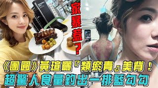 《團圓》黃瑄曬『類瘀青』美背！超驚人食量釣出一排藍勾勾│ Vidol.tv