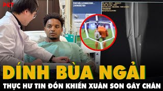 THỰC HƯ TIN ĐỒN DÙNG BÙA NGẢI hại Xuân Son ngã gãy chân MẤT CẢ SỰ NGHIỆP? | PKT