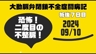 ★大動脈弁閉鎖不全症闘病記20240910 20241101 0419