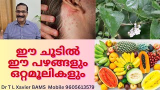 ചൂടുകുരു | Secrets to Keep Your Skin Safe in the Summer Heat