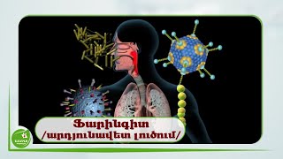 Ֆարինգիտ /Արդյունավետ Լուծում/ - #Առողջնախագիծ