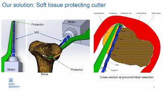 Novel Robotic Soft Tissue Protecting Cutter for Bone Resections in Total Knee Arthroplasty