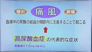 いわて元気○（マル）　【痛風②治療法と注意点】（2017/8/23放送　ニュースプラス１）