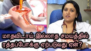 Abnormal Uterine Bleeding Causes \u0026 Treatment | Dr. Deepa Vinay Nambiar | Samayam Tamil