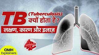 Tuberculosis TB क्यों होता है I लक्षण, कारण और इलाज़ I World TB Day I OMH Explainers