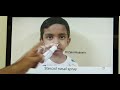 Allergic rhinitis in children Part 2 (Hindi) Patient teaching programme