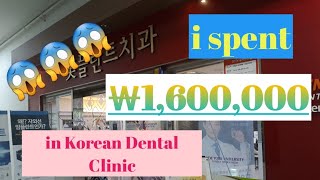 #MiPlantDentalClinic #SouthKorea I spent 1,600,000won or 75,000thousandPESOS for my teeth