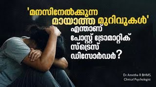 PTSD || മനസ്സിനേൽക്കുന്ന മായാത്ത മുറിവുകൾ നിങ്ങളുടെ ജീവിതത്തിൽ ഉണ്ടായിട്ടുണ്ടോ || Dr. Amritha Ramesh