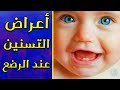 اعراض التسنين عند الرضع