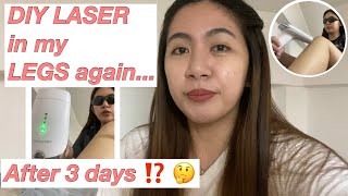 DIY LASER Hair Removal in my LEGS again AFTER 3 DAYS! (Lescolton IPL)