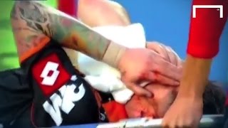 Ouch! Player gets badly injured whilst scoring