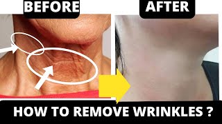 🛑 STOP TURKEY NECK  and NECK WRINKLES ! ANTI-AGING FACE EXERCISES FOR NECK \u0026 CHEST | FULL COLLECTION