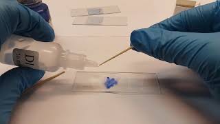 How to dye a cheek cell slide *Rebel Method