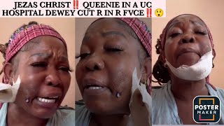 OMG Dewey Stvb Queenie In R Face And She Deh Up A UC Hospital A Cuss Out Dem Rvss JK A Cyst Lol