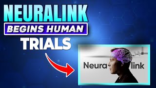 Neuralink Brain Implant Begins Human Trials: What Does This Mean For Our Future?