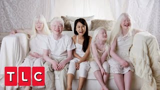 This Couple Adopted Four Children With Albinism | Born with Albinism