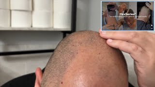 Freebird Flex Series Shaver Review – DO NOT BUY ⚠️