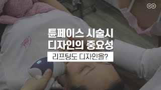 튠레이저편 - 튠페이스도 디자인이다! [MH클리닉]