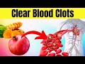 Unbelievable Health Trick to Clear Your Blood Clot - #1 Will Blow Your Mind!