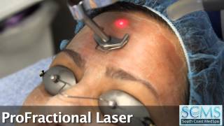 Los Angeles Laser Acne Scar Resurfacing