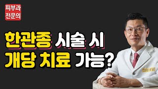 [아그네스 개발 병원]한관종 시술 시 개당 치료가 가능할까?