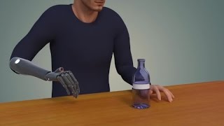 This bionic arm has vision