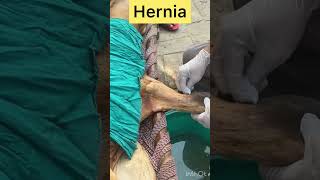 Hernia l umbilical hernia l Dr Umar Khan