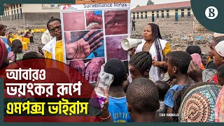 বাড়ছে এমপক্স ভাইরাসের প্রাদুর্ভাব; ডব্লিওএইচওর সতর্কতা জারি; কীভাবে ছড়ায় এটি?| The Business Standard