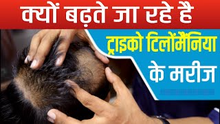 What is Trichotillomania? Treatment of Trichotillomania (Hair Pulling Disorder) By Dr. Mukesh!