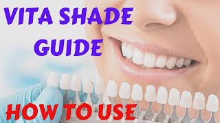 Vita Shade Guide - Classic 3D Master - Dental Tooth Shade Selection | Secrets to Use In shade Guide