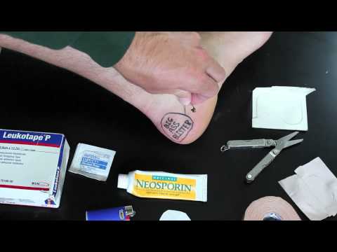How To Clean And Dress Blisters For Hiking How To Clean And Dress Blisters For Hiking