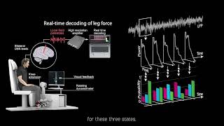 BCI Award 2022 Nomination-Real-time decoding of leg motor function from subthalamic nucleus in PD