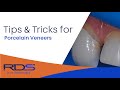 Tips and tricks porcelain veneers