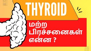 தைராய்டு பிரச்சனையினால் உடலில் ஏற்படும் மற்ற பிரச்சனைகள்  என்ன ? #ShifaHospitals #Tirunelveli