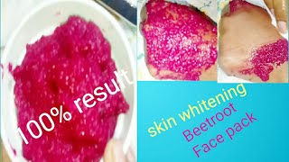 DIY Instant skin whitening Mask // కేవలం 15 నిll లలో తెల్లని అందమైన ముఖం//In telugu