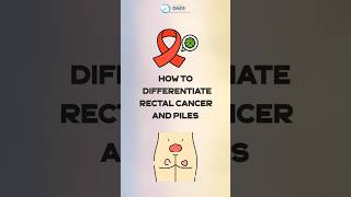 How to differentiate Rectum Cancer and Piles? | Dr Aditya Kulkarni #dradityakulkarni #oasisclinic