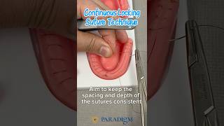 Continuous Locking Suture Technique
