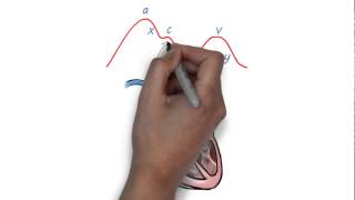 JVP waveform explained