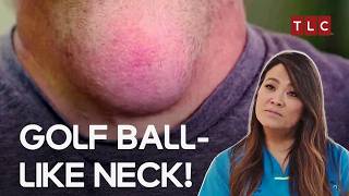Giant Neck Lump & Forehead Mysteries | Dr Pimple Popper S3 EP5 | TLC